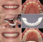 Snap On Smile Comfort Fit Flex Cosmetic Teeth Upper Lower Flex Dental - Image 6